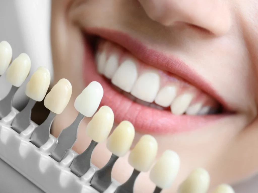 Woman smiling in a cosmetic dentist clinic